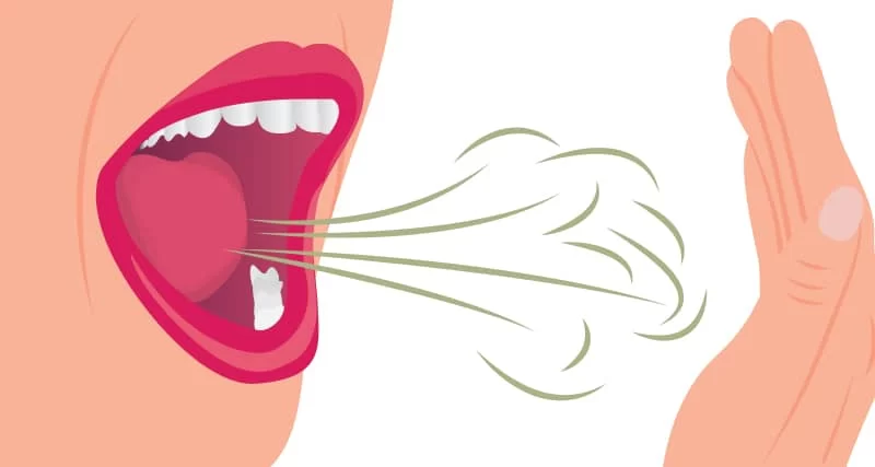 The Relationship Between a Healthy Diet and Preventing Bad Breath | Best Foods for Fresh Breath