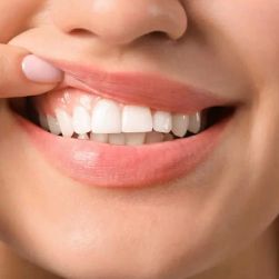 Best Oral Habits to Follow for Avoiding Gingivitis and Maintaining Healthy Gums