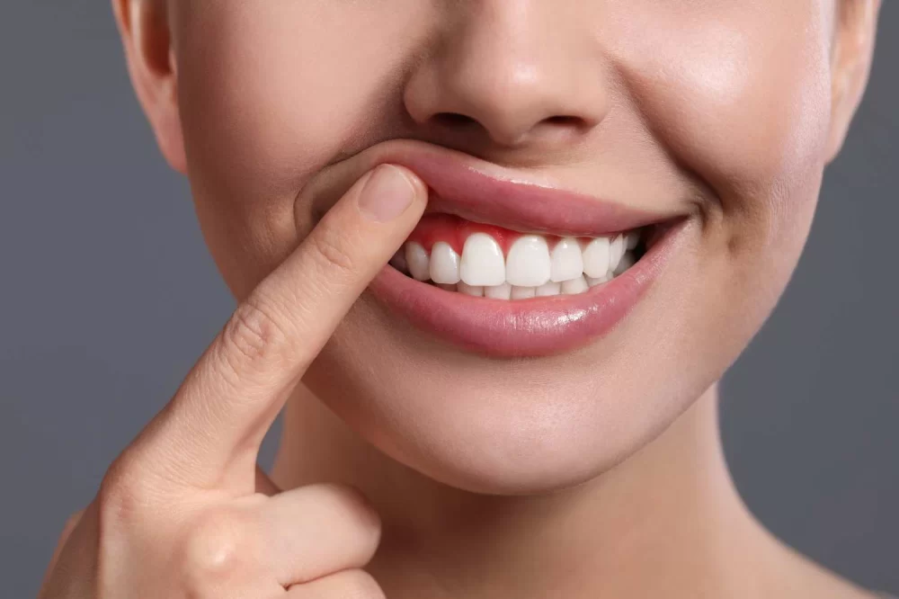 Propolis for Oral Health and Gum Inflammation Relief: A Natural Solution