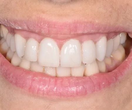 Burnaby Heights Dental Centre
