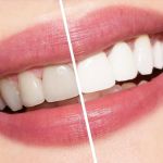 Newman Family Dental