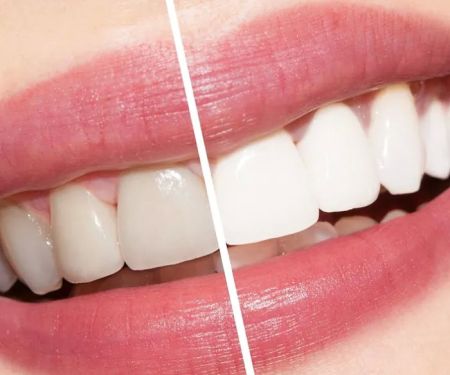 Newman Family Dental