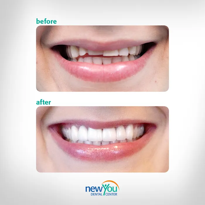 New You Dental Center Picture 10