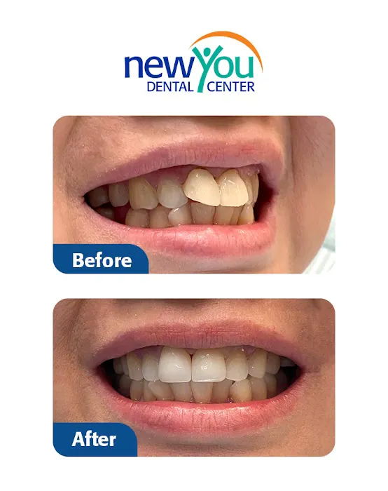 New You Dental Center Picture 1
