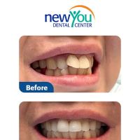 New You Dental Center ico
