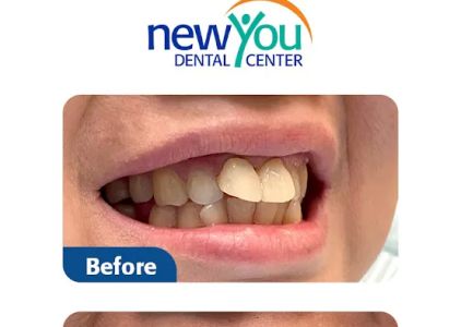 New You Dental Center
