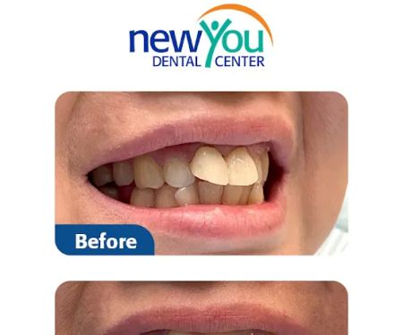 New You Dental Center