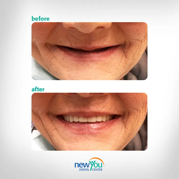 New You Dental Center Picture 9