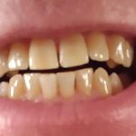 Saline Family Dentistry