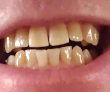 Saline Family Dentistry