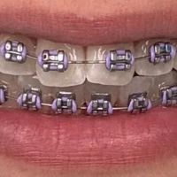Lakeshore Dental Specialists ico
