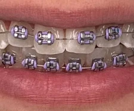Lakeshore Dental Specialists