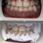 Deluxe Dental Oak Park - Family Dentistry