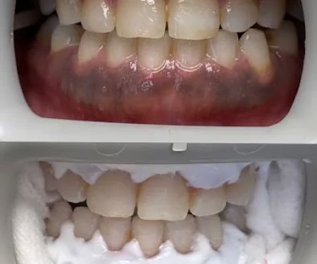 Deluxe Dental Oak Park - Family Dentistry