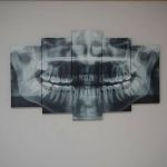 Dental Care Of Canton
