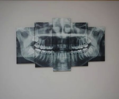 Dental Care Of Canton