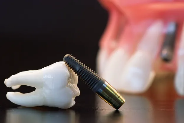 Dentistry 2000 Picture 2
