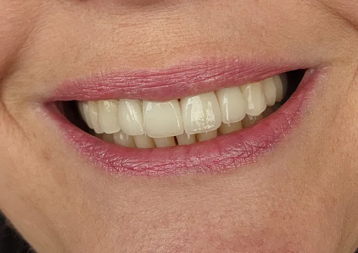Pristine Dentistry Picture 5