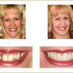 Dentistry for San Diego