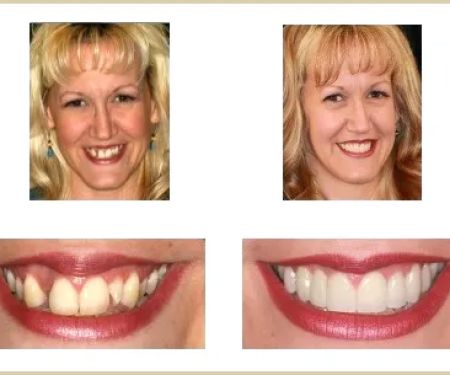 Dentistry for San Diego