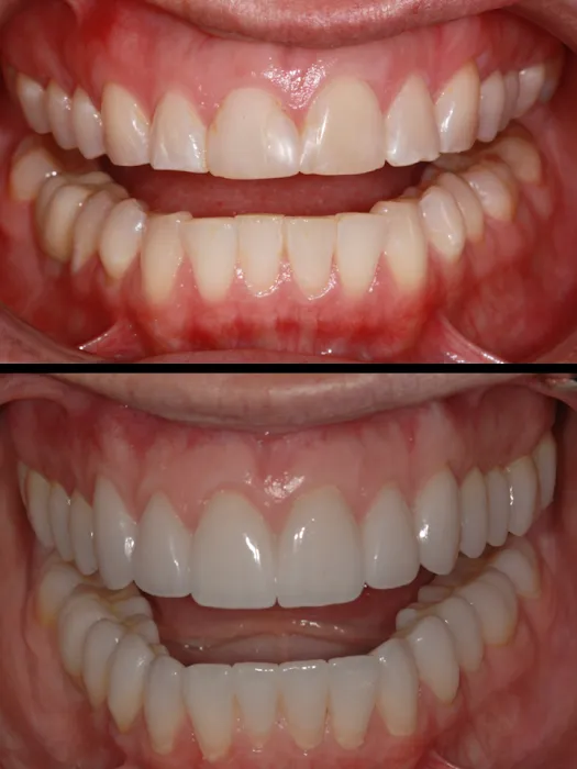 Bernardo Center Dentistry Picture 5