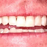 Ramona Family Dentistry ico