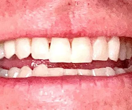 Ramona Family Dentistry