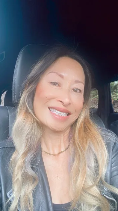 Lovebites Dental San Diego 3