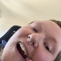 Lovebites Dental San Diego ico