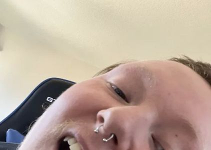 Lovebites Dental San Diego