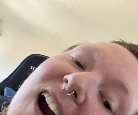 Lovebites Dental San Diego