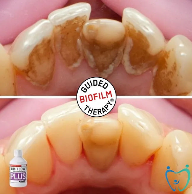 Rancho Penasquitos Dental Center Picture 7