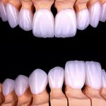 RR Smiles | Cosmetic Dentist in San Diego