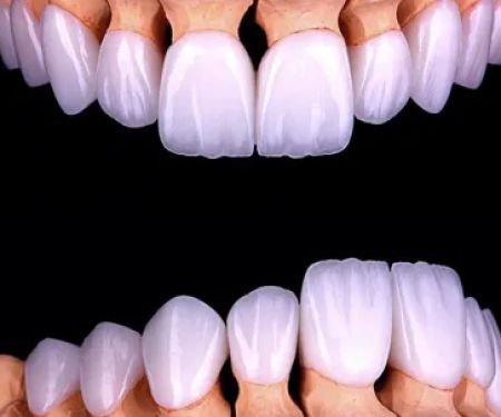 RR Smiles | Cosmetic Dentist in San Diego