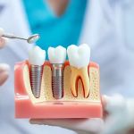 Restore Dental Kansas City