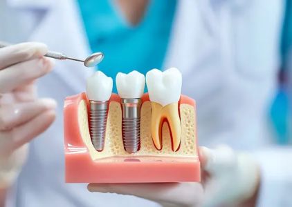 Restore Dental Kansas City