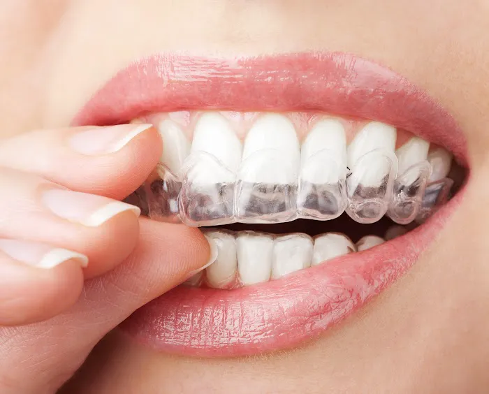 Elevation Family Dental - Dr. Judd Chamberlain Picture 2