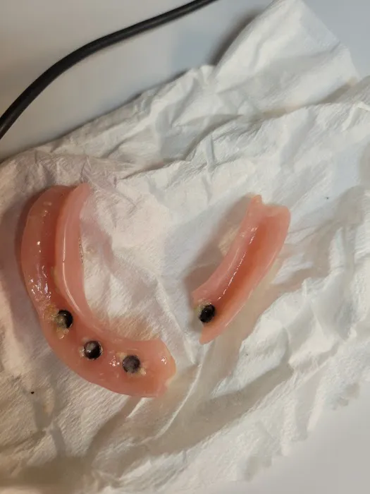 Affordable Dentures & Implants Picture 5