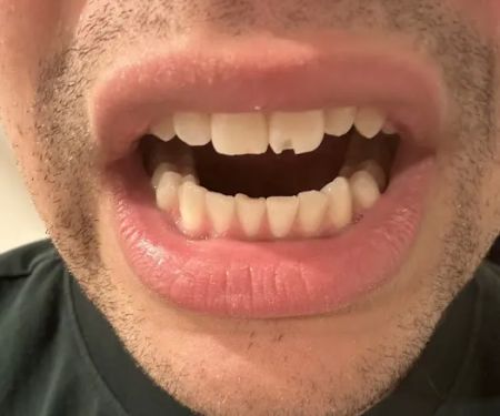 Smilin Dental