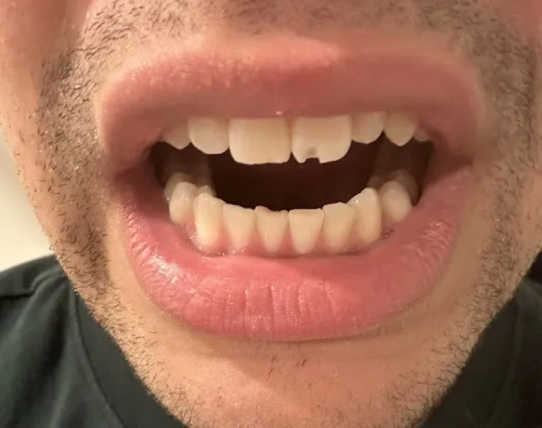 Smilin Dental