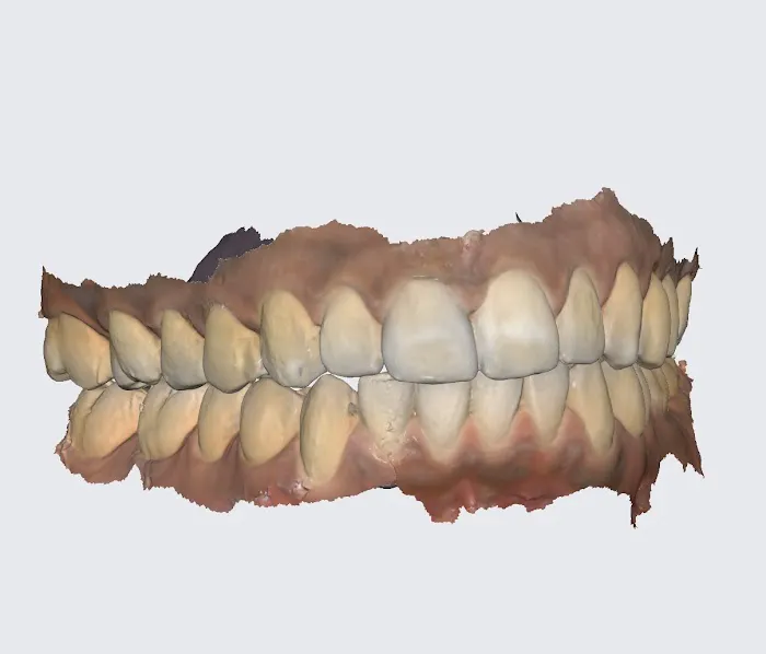 Mindful Dental Picture 10