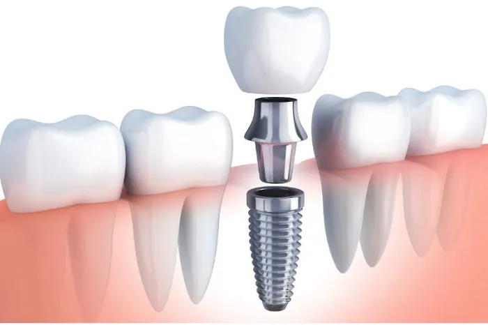 Bedir Family Advanced Laser & Implant Dentistry 9