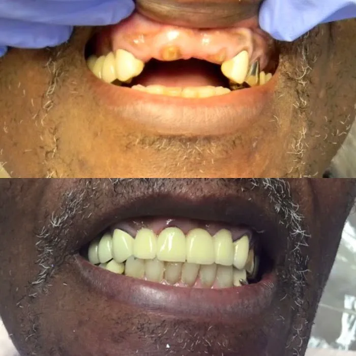 Bedir Family Advanced Laser & Implant Dentistry 6