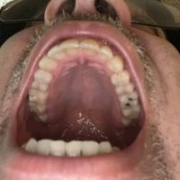 Gentle Dental Care: Dentist Timothy C Liu DDS ico