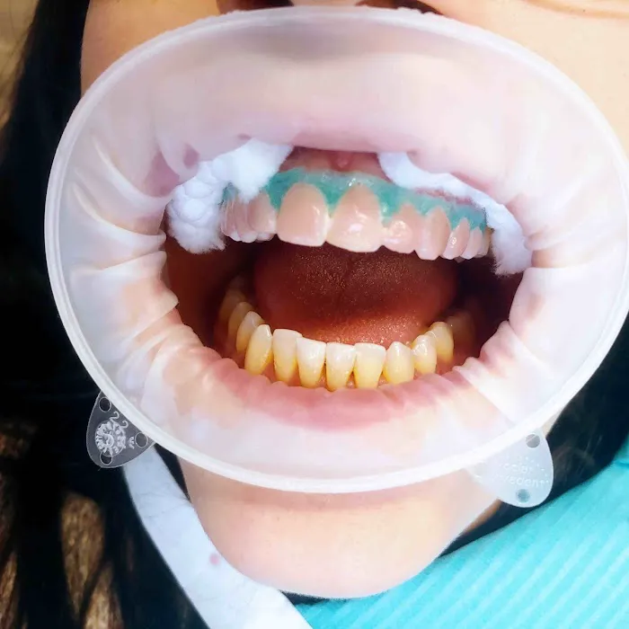 Diamond Dental of Beachwood; Barry Diamond D.D.S. 6