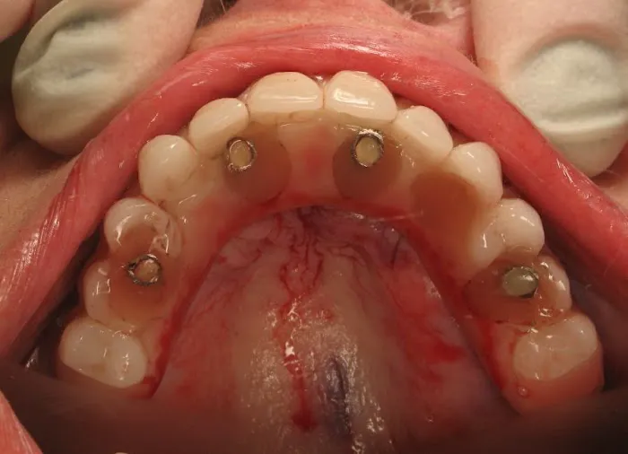 The Healthy Smile Dental Center: Dr. Jeffrey Gross DDS FAGD 5