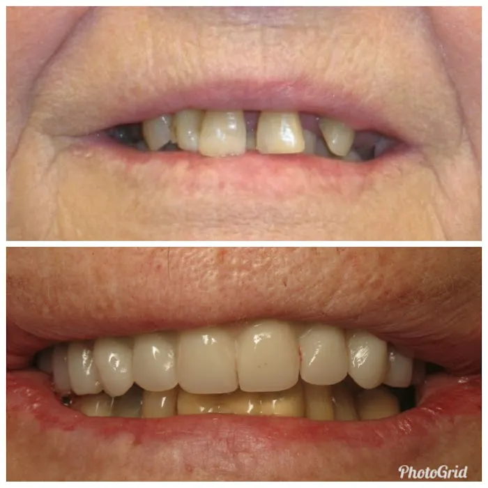 The Healthy Smile Dental Center: Dr. Jeffrey Gross DDS FAGD 6