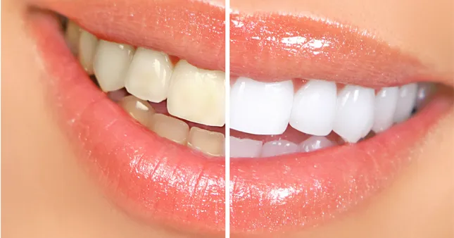 The Healthy Smile Dental Center: Dr. Jeffrey Gross DDS FAGD 8