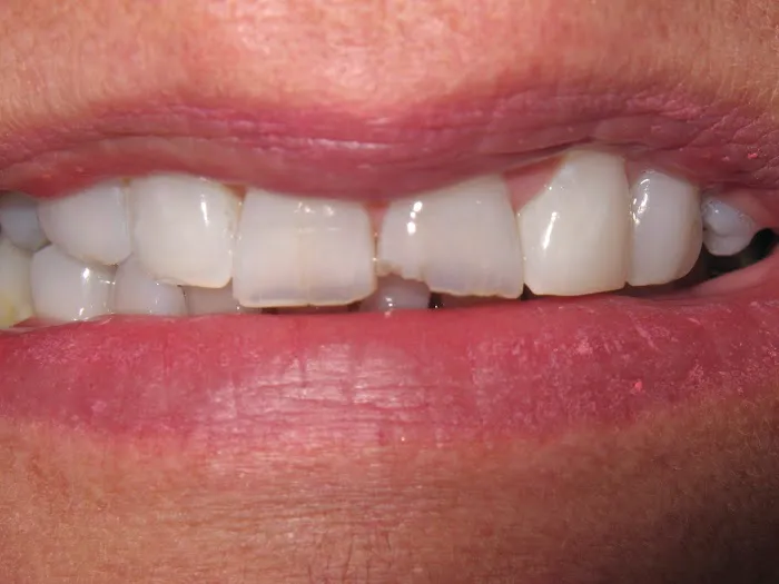 new32 Aesthetic and Family Dentistry Picture 9