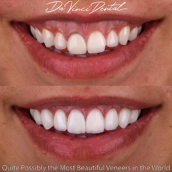 Da Vinci Dental Picture 8